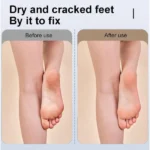 Râpe Électrique Anti-callosités pour Pieds Velvet Smooth – Image 4
