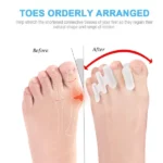 pexmen 2 pièces mathiateur séparateur d'orteils d'hallux valgus en gel silicone médical