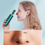 appareil d'aspiration de microdermabrasion 3en1 pour points noirs led avec écran lcd