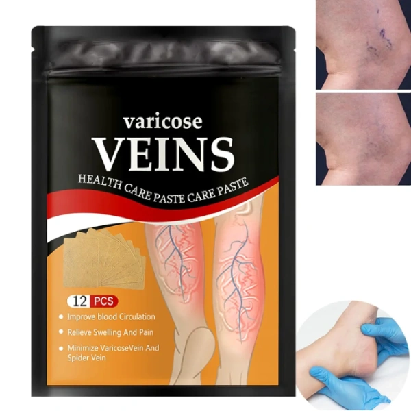 Varicose Veins Patchs de Traitement des Varices Naturels - 12 Pcs varicose veins patchs de traitement des varices naturels 12pcs