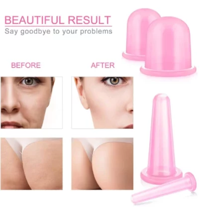 kit de 7 ventouses en silicone pour massage anti-rides anti-cellulite par thérapie chi ping