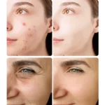 Kojic Acid Face Serum – Sérum visage éclaircissant, hydratant, anti-âge à l'acide kojique – Image 4