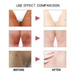 Pack Snow Bleach Cream - Crème Éclaircissante Zones Intimes & Corps – Image 6