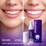 vasalaine v34 dentifrice sérum correcteur de couleur blanchissement dents