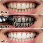 Dr. Rashel Charcoal Whitening Toothpaste – 100ml – Image 3