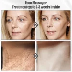 Appareil de Massage Anti-Rides Visage & Cou 4en1 – EMS & Photothérapie – Image 4