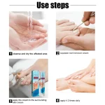 Nail Fungus Crème Antifongique Anti-Mycose Réparatrice pour Ongles – Image 3