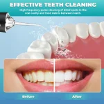 Nettoyeur Irrigateur Buccal Hydropulseur Dentaire Portable – 220ml – Image 2