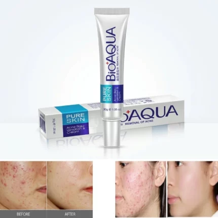 crème réjuvénatrice anti-acné anti-cicatrices bioaqua 30g