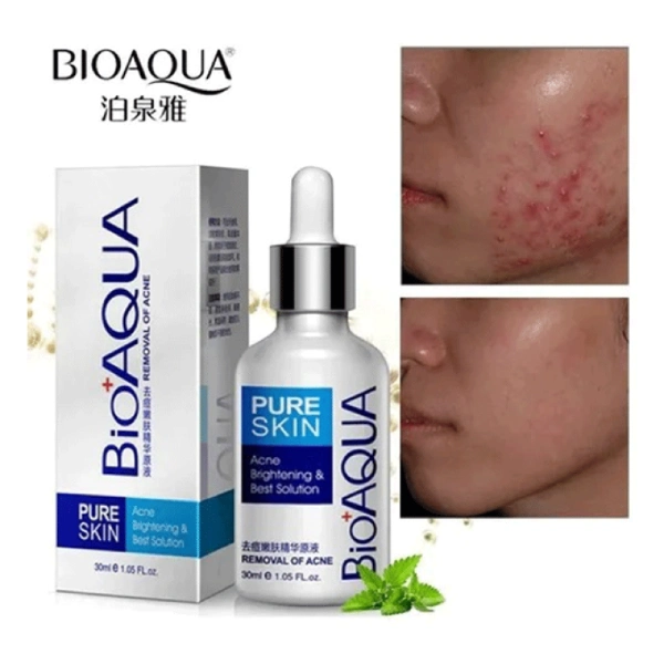 sérum clarifiant anti-acné bioaqua 30ml